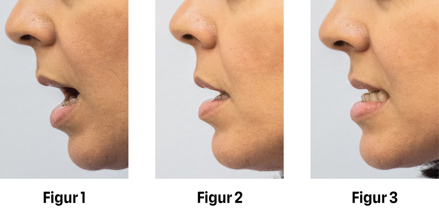 Rörelseträning vid käkledsknäppning