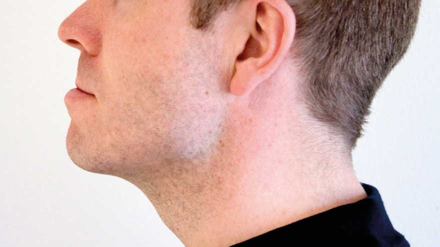 Bild som visar rörelseträning för käken