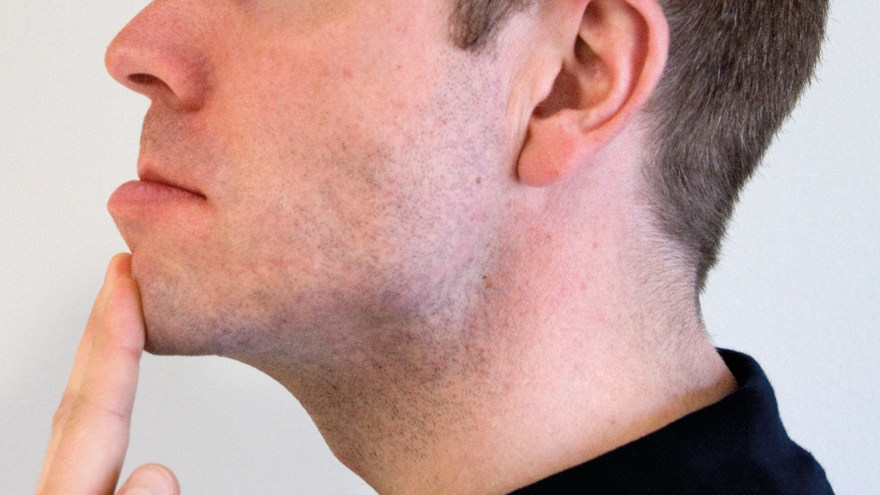 Bild som visar rörelseträning för käken